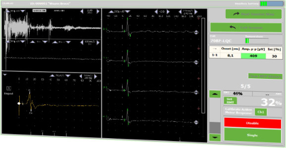 DuoMAG rTMS-Software