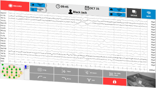 TruScan EEG-Erfassung im Intensivstationsmodus